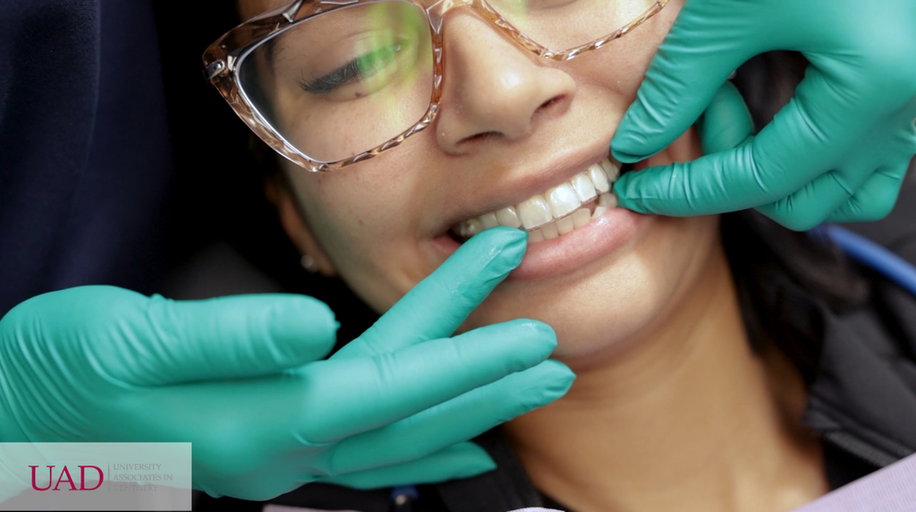 Clear aligner tray seated over adult teeth and nearly invisible, the reason many adults pick Invisalign® vs. braces for adults, Invisalign® vs. Braces for Adults, University Associates in Dentistry