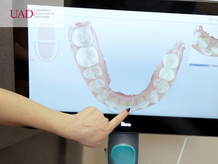 Dr. Lauren Zalay reviewing an iTero treatment simulation with a patient at the complimentary consultation that settles Invisalign® vs. braces for adults, Invisalign® vs. Braces for Adults, University Associates in Dentistry